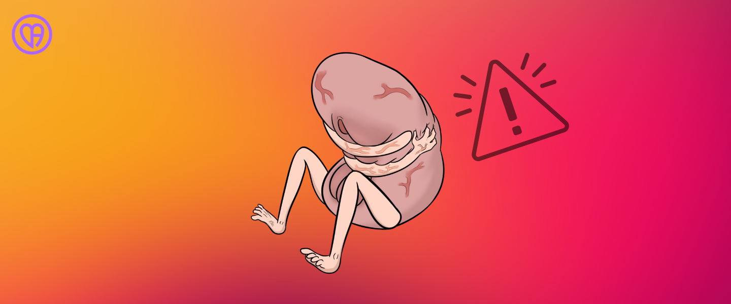 Buka-bukaan soal Gancet Bisa Terjadi Karena Vaginismus